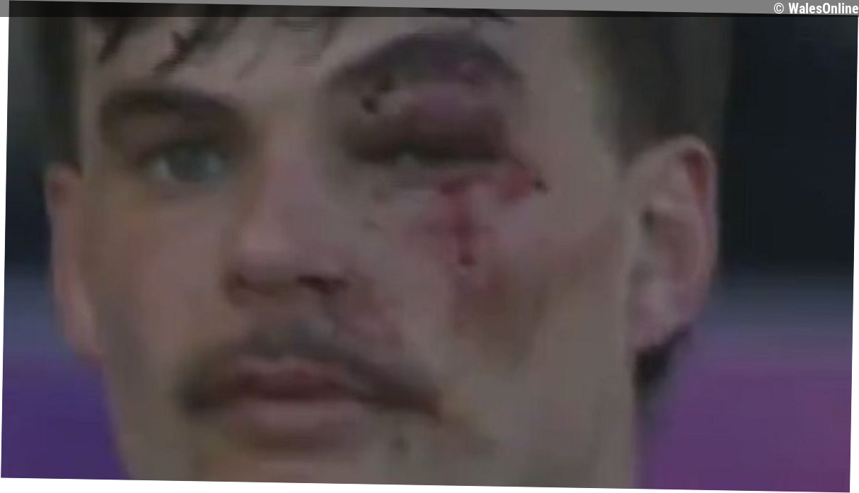 England star left with gruesome injury as Wales international reacts angrily
