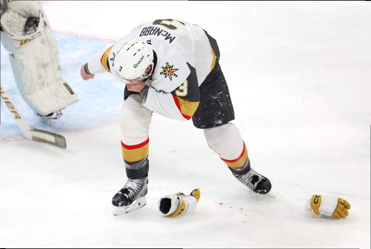 Golden Knights' Brayden McNabb exits Game 2 of Stanley Cup Final after taking slap shot to face