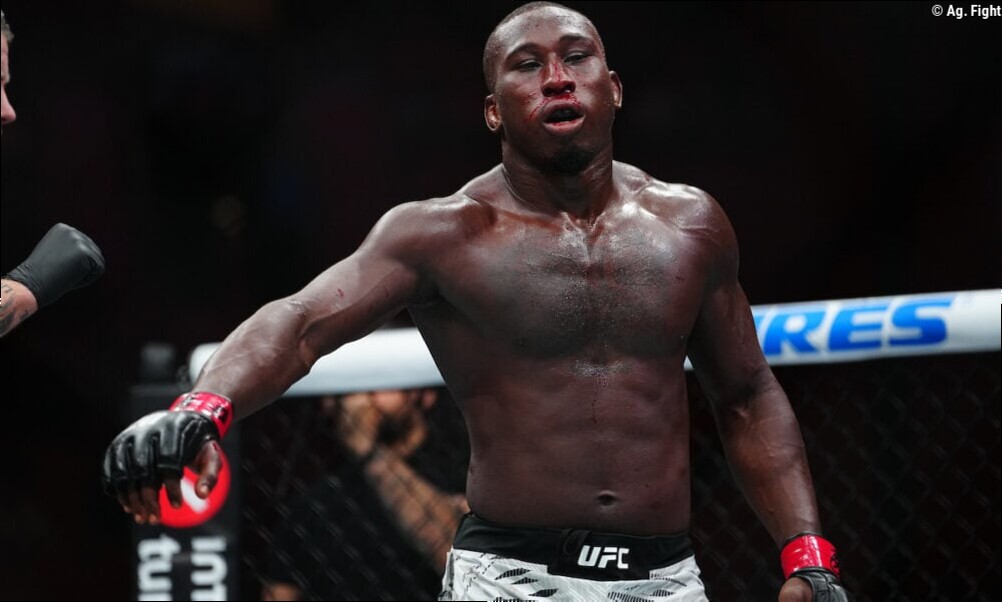 Banguela! Americano exibe estrago na boca após perder dentes em luta do UFC 330; veja