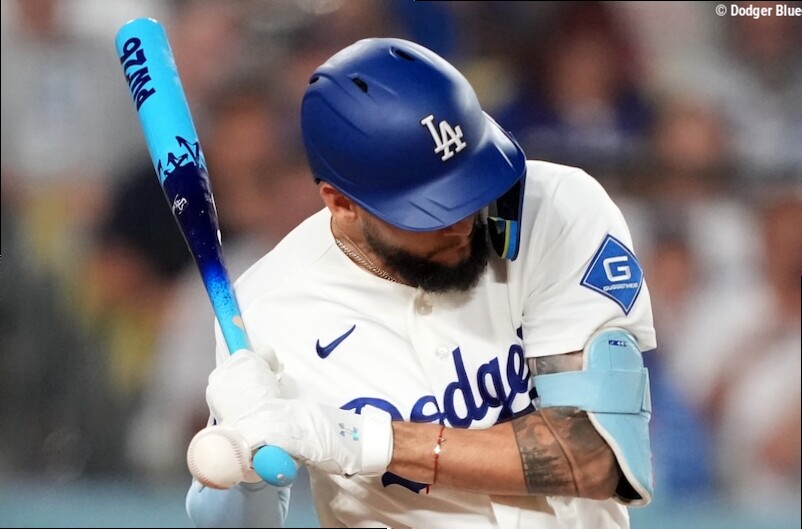 Andy Pages Potentially Needs Surgery For Left Hand Fracture