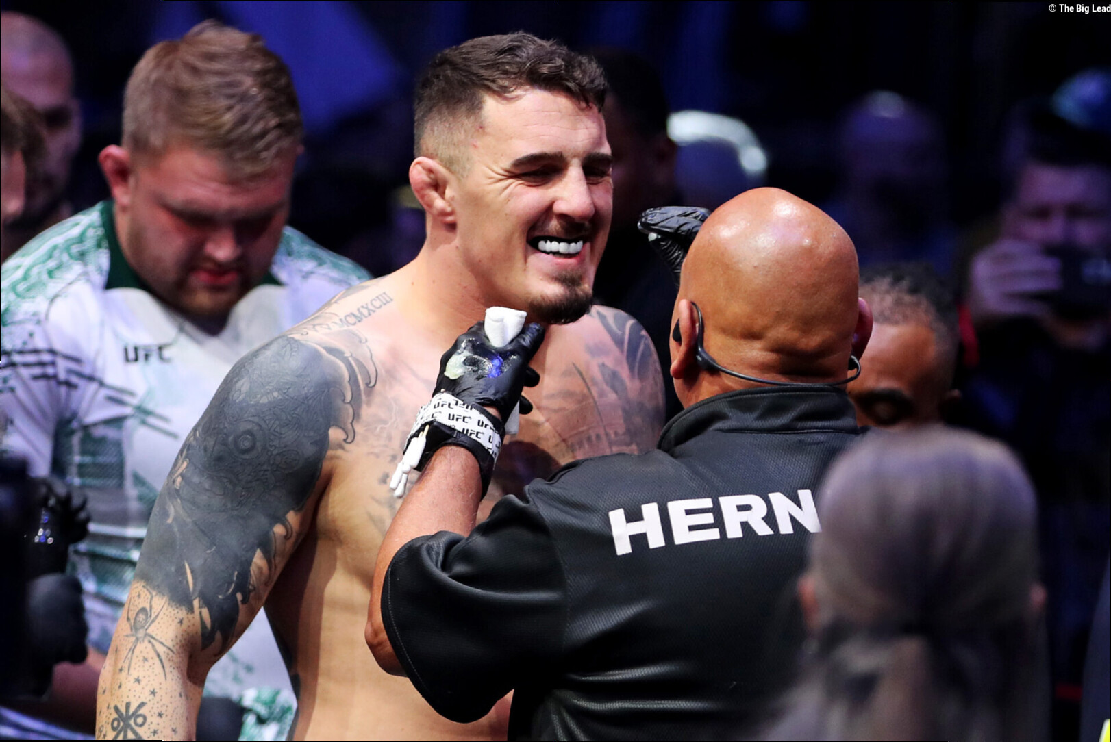 Eddie Hearn drops major update on Tom Aspinall's return status