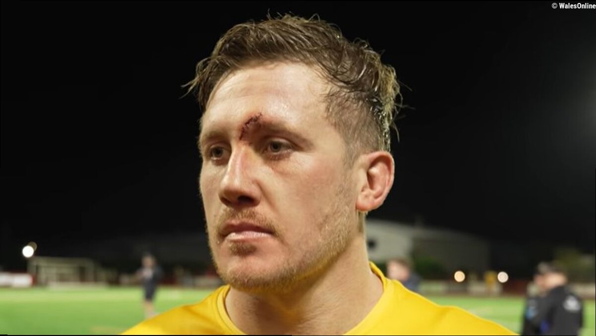 Wales international scarred in training accident and Springboks statement issued