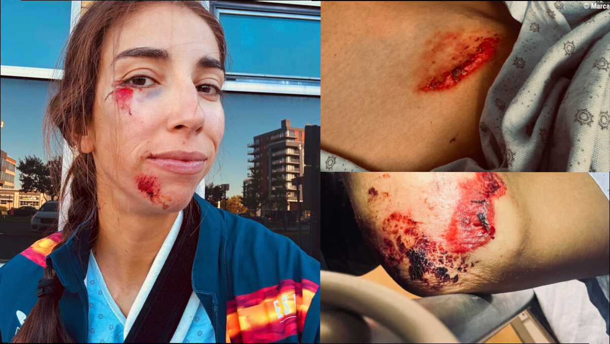 El durísimo adiós de Sandra Alonso al Mundial horas antes de la gran cita: "Le embestí y poco más recuerdo…"