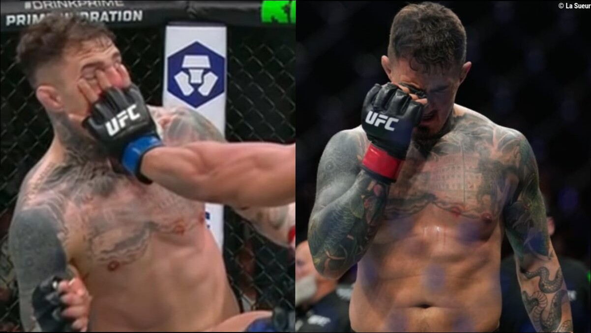 L'arbitre UFC Marc Goddard trouve la solution miracle contre les eye pokes